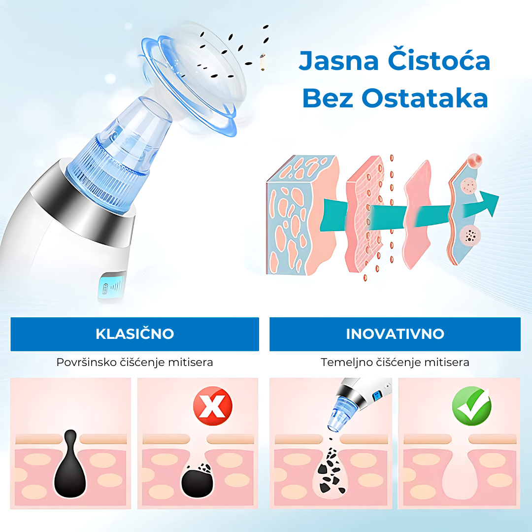 Čistač kože - za savršeno čisto lice