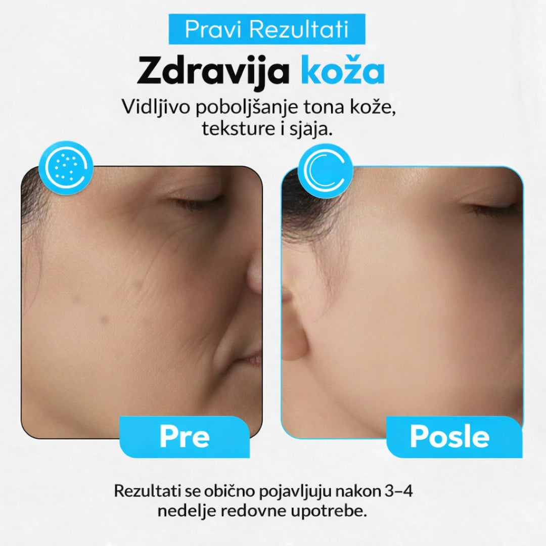 Pro LED maska za negu lica