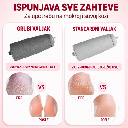 Elektro Kamen Turpija za pete - 2 kamena